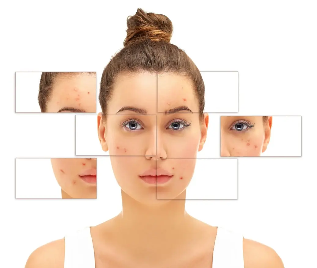 Skin Conditions that a can Dermatologist Treat in Kannur